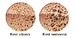 osteoporosis 0310.jpg